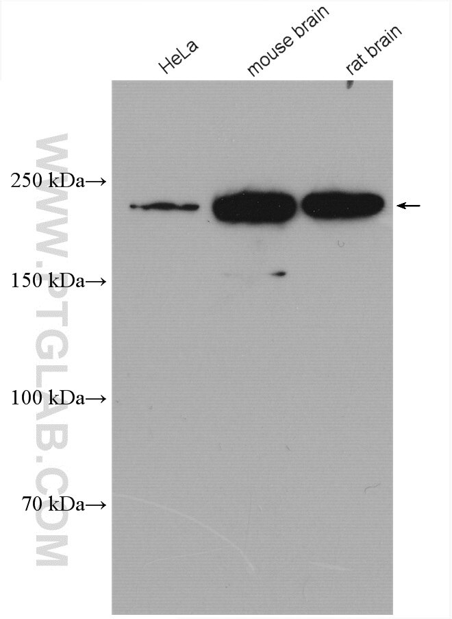 Western Blot (WB) analysis of various lysates using MYH10-Specific Polyclonal antibody (19673-1-AP)