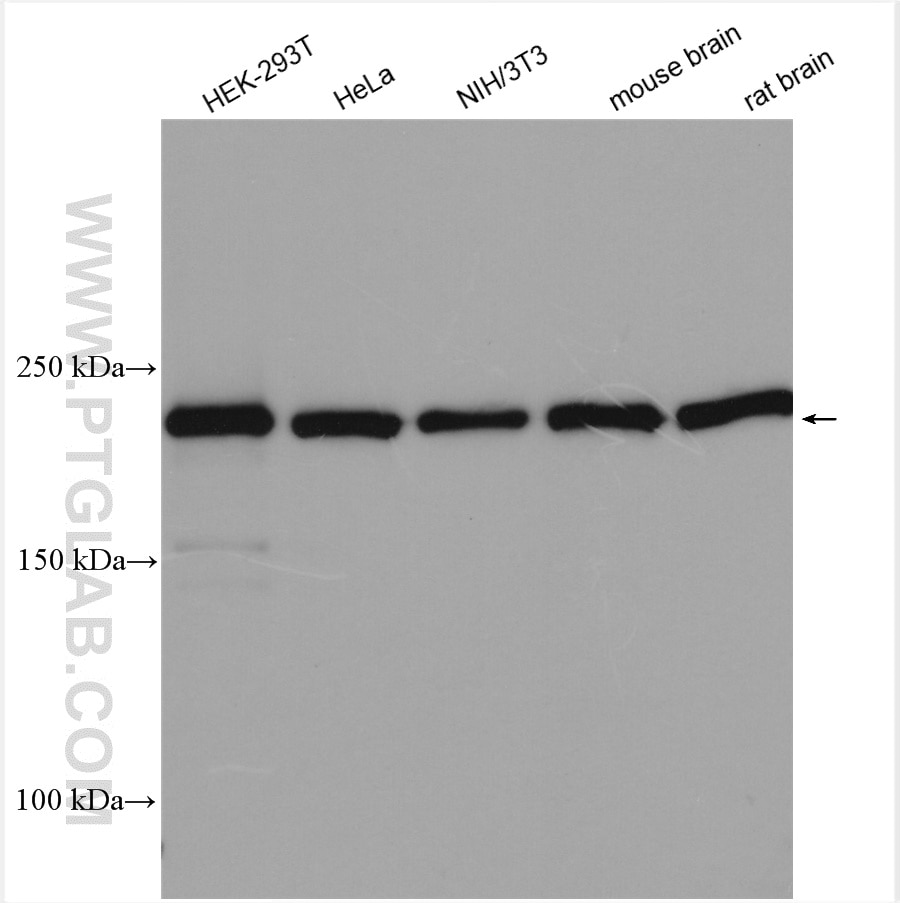 Western Blot (WB) analysis of various lysates using MYH10-Specific Polyclonal antibody (19673-1-AP)