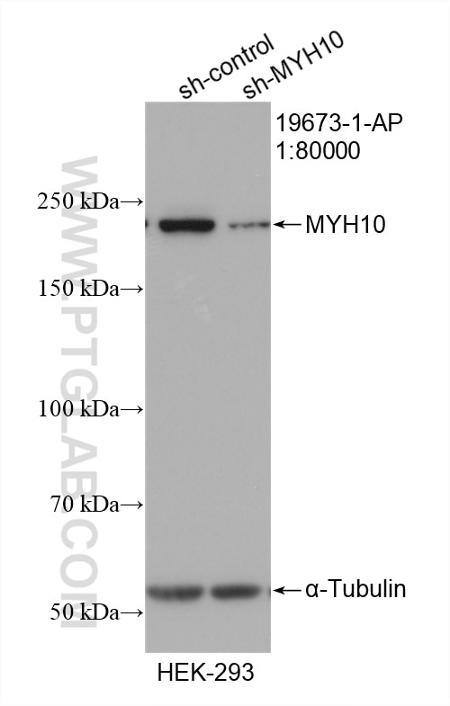 Western Blot (WB) analysis of HEK-293 cells using MYH10-Specific Polyclonal antibody (19673-1-AP)