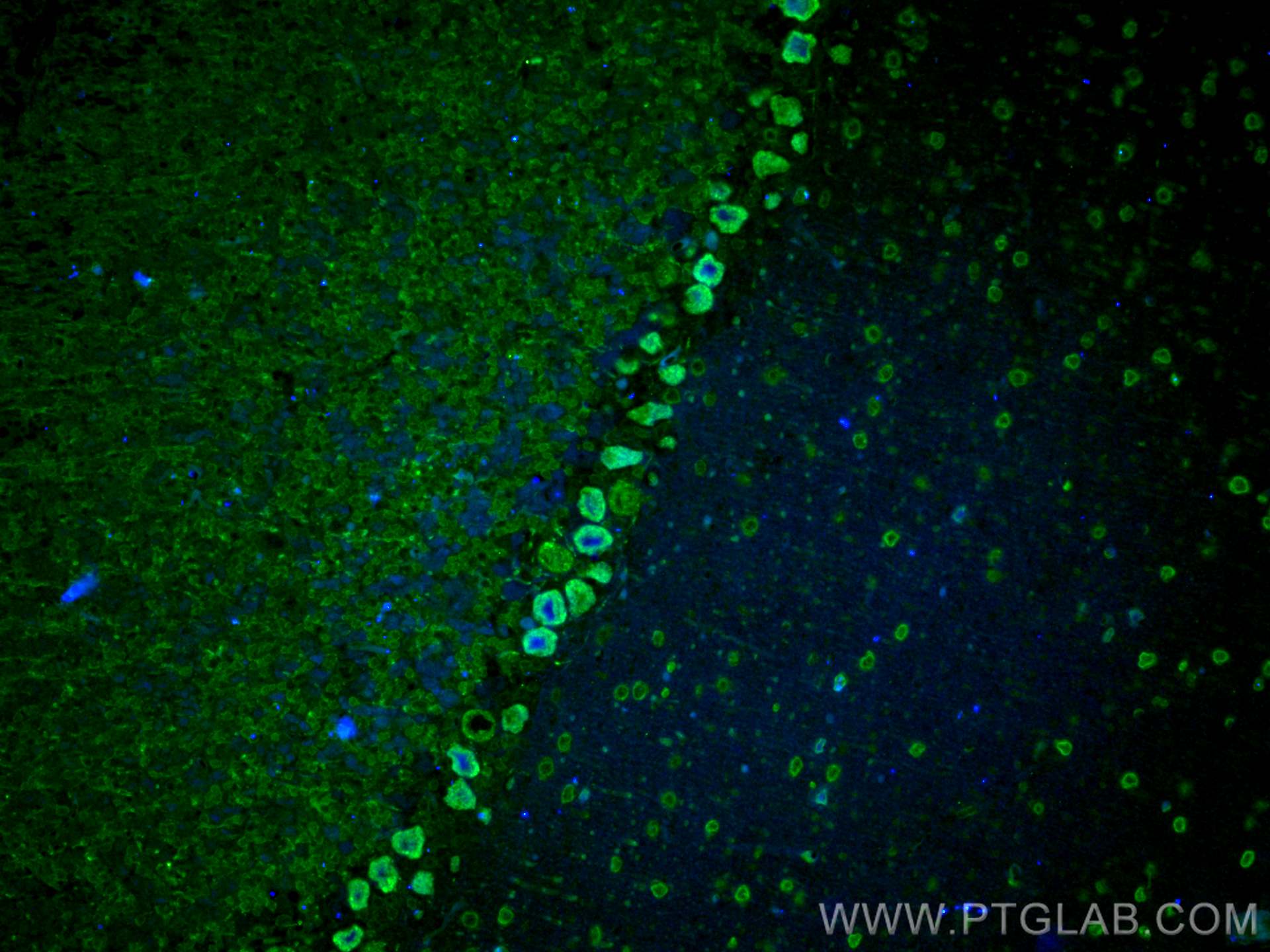 Immunofluorescence (IF) / fluorescent staining of mouse cerebellum tissue using CoraLite® Plus 488-conjugated MYH10-Specific Polyc (CL488-19673)