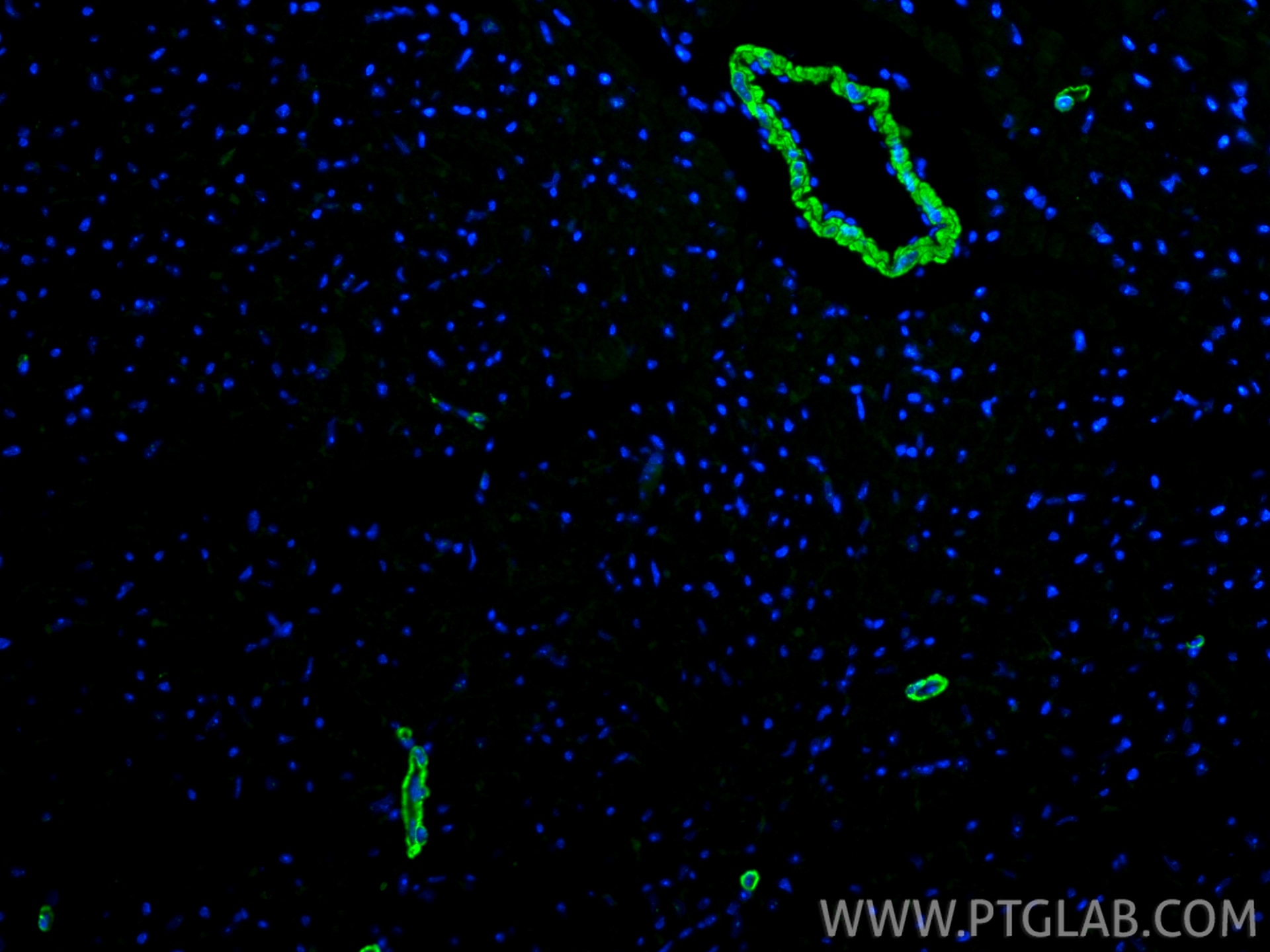IF Staining of mouse heart using 18569-1-AP Immunofluorescence (IF) / fluorescent staining of mouse heart tissue using SMMHC Polyclonal antibody (18569-1-AP)