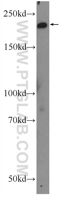 Western Blot (WB) analysis of rat uterus tissue using SMMHC Polyclonal antibody (18569-1-AP)