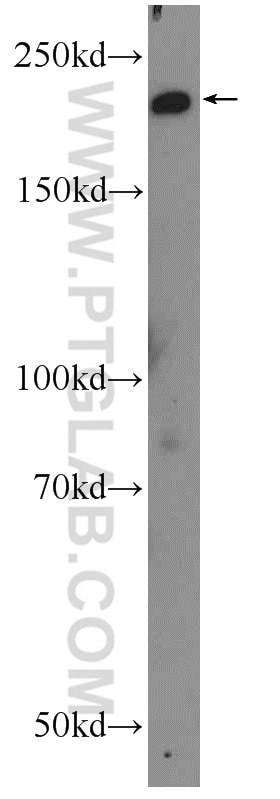 WB analysis of rat uterus using 18569-1-AP