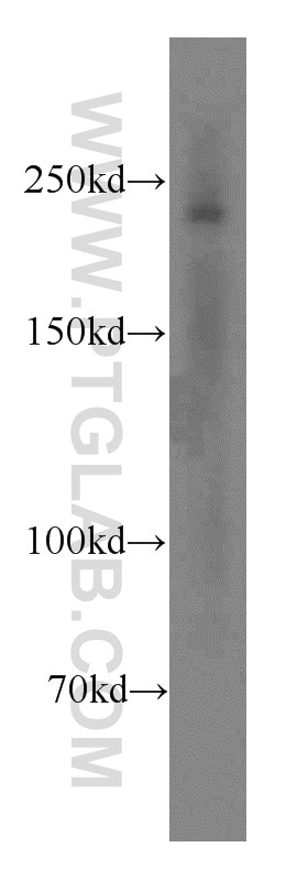 Western Blot (WB) analysis of mouse uterus tissue using SMMHC Polyclonal antibody (18569-1-AP)