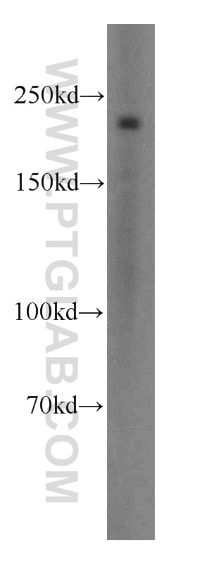 Western Blot (WB) analysis of mouse colon tissue using SMMHC Polyclonal antibody (18569-1-AP)