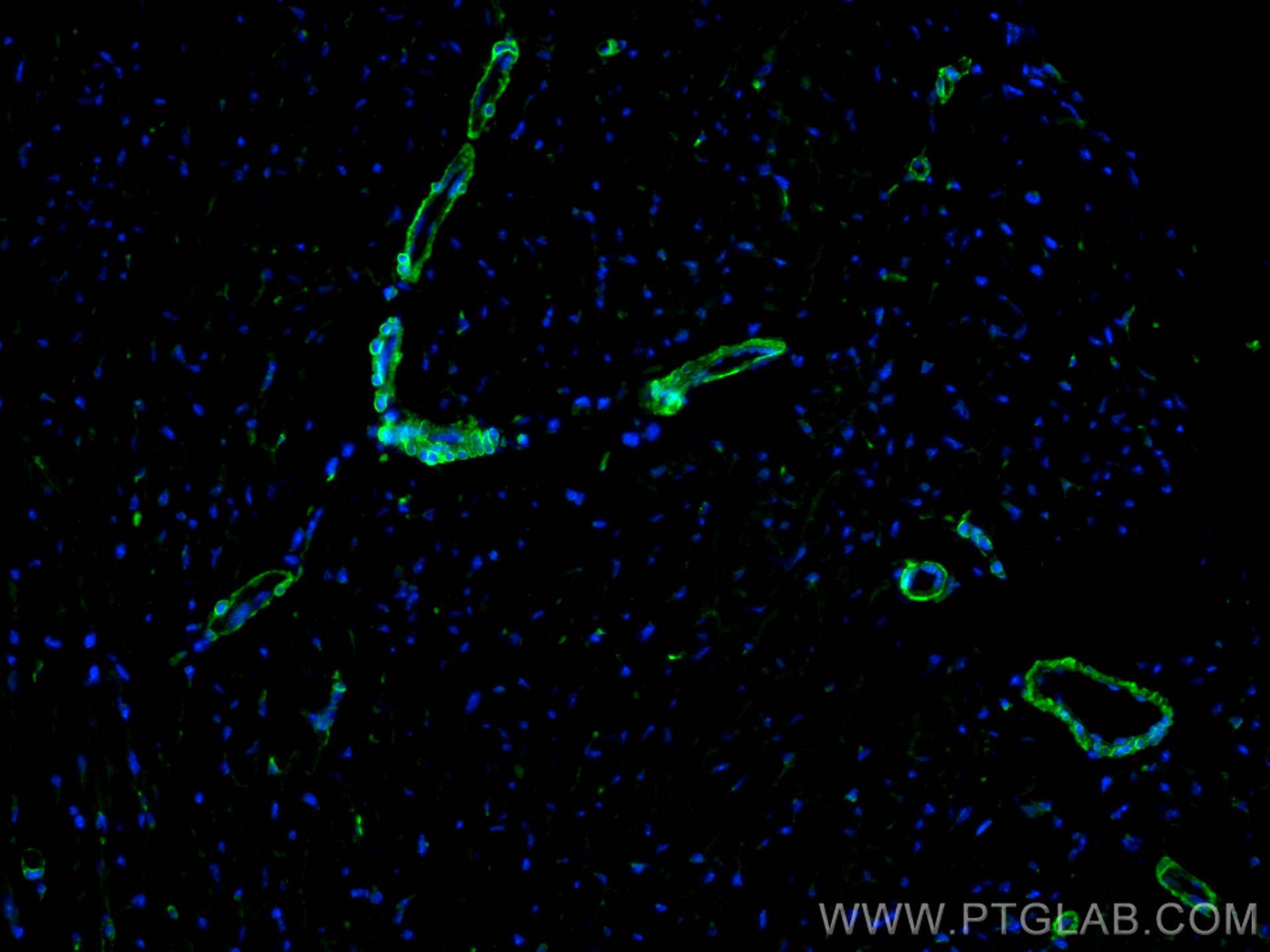 Immunofluorescence (IF) / fluorescent staining of mouse heart tissue using SMMHC Polyclonal antibody (21404-1-AP)