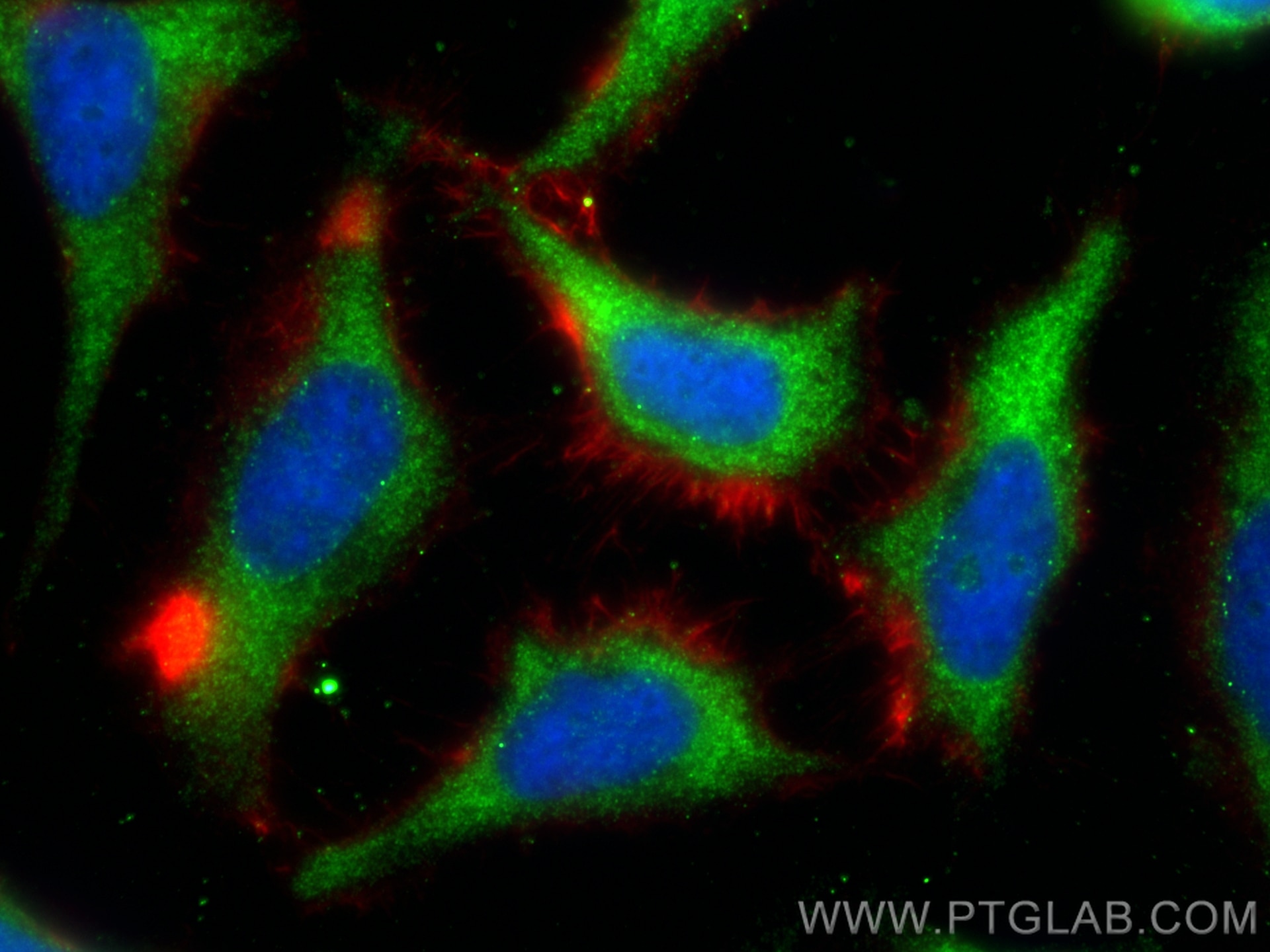 Immunofluorescence (IF) / fluorescent staining of HeLa cells using SMMHC Polyclonal antibody (21404-1-AP)