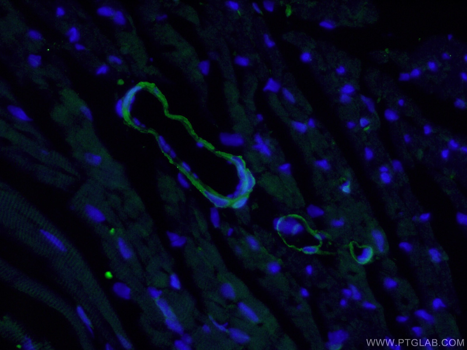 Immunofluorescence (IF) / fluorescent staining of mouse heart tissue using SMMHC Polyclonal antibody (21404-1-AP)