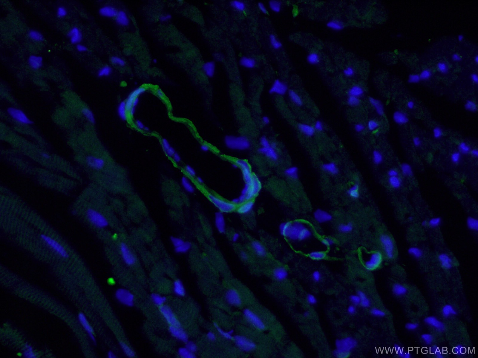 IF Staining of mouse heart using 21404-1-AP