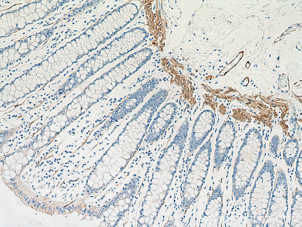 Immunohistochemistry (IHC) staining of human colon tissue using SMMHC Polyclonal antibody (21404-1-AP)