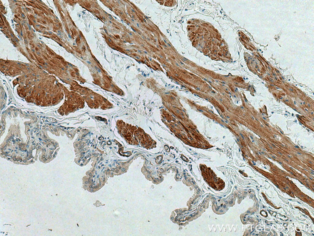 Immunohistochemistry (IHC) staining of rat bladder tissue using SMMHC Polyclonal antibody (21404-1-AP)