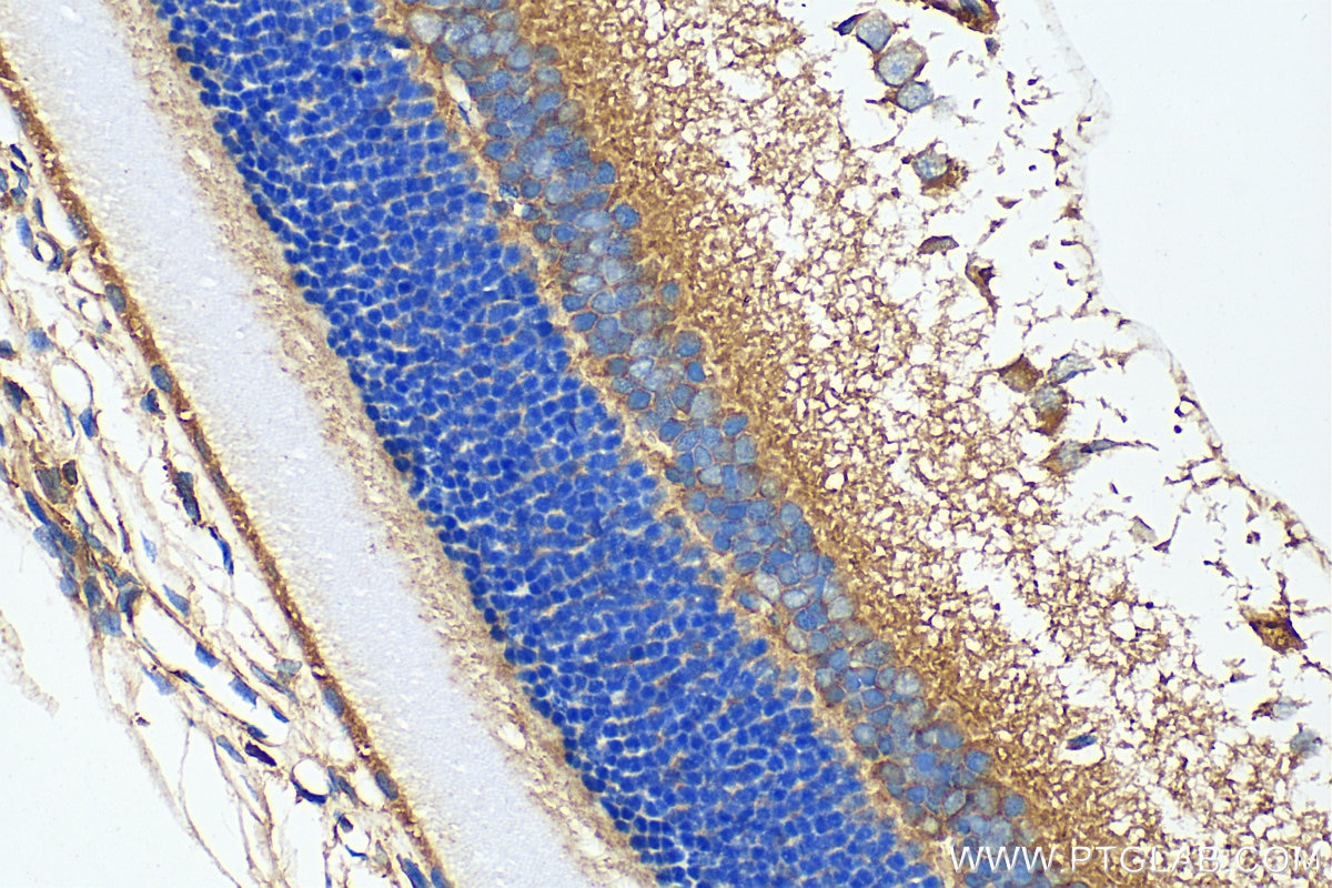 Immunohistochemistry (IHC) staining of rat eye tissue using SMMHC Polyclonal antibody (21404-1-AP)