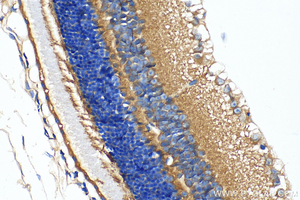 Immunohistochemistry (IHC) staining of mouse eye tissue using SMMHC Polyclonal antibody (21404-1-AP)