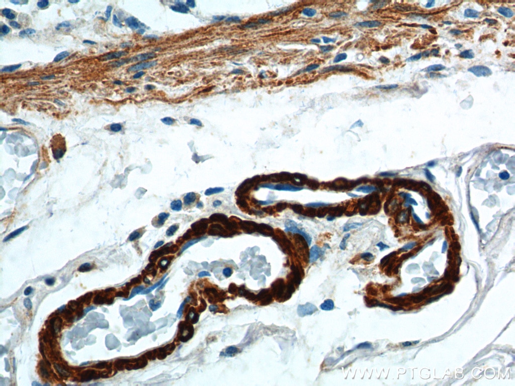 SMMHC Polyclonal antibody