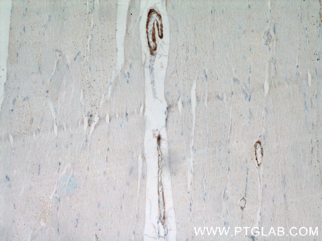 IHC staining of human skeletal muscle using 21404-1-AP