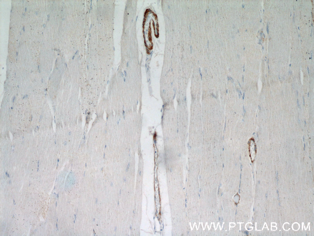 Immunohistochemistry (IHC) staining of human skeletal muscle tissue using SMMHC Polyclonal antibody (21404-1-AP)