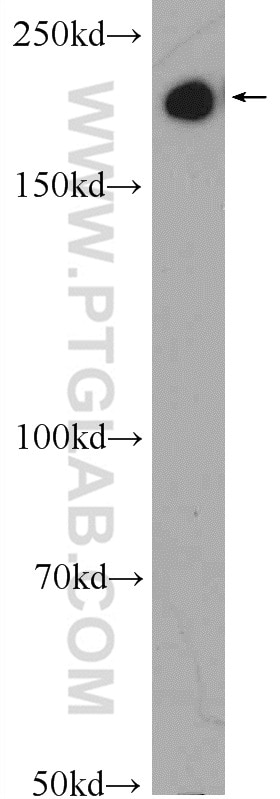 Western Blot (WB) analysis of mouse uterus tissue using SMMHC Polyclonal antibody (21404-1-AP)