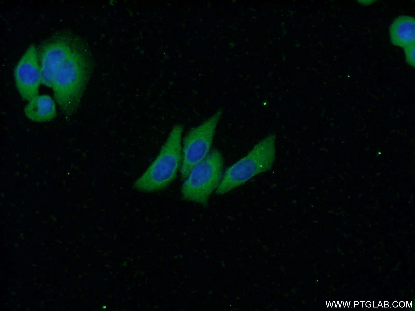 Immunofluorescence (IF) / fluorescent staining of HeLa cells using SMMHC Monoclonal antibody (60222-1-Ig)