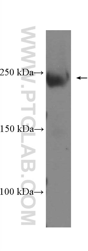 Western Blot (WB) analysis of human ileum tissue using SMMHC Monoclonal antibody (60222-1-Ig)