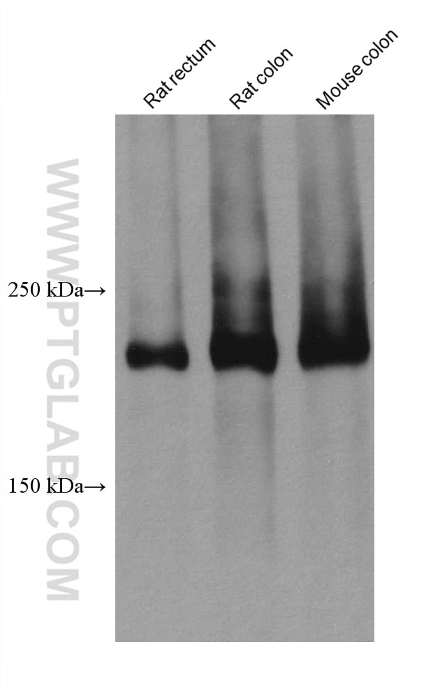Western Blot (WB) analysis of various lysates using SMMHC Monoclonal antibody (60222-1-Ig)