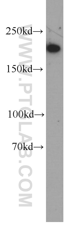 Western Blot (WB) analysis of HeLa cells using SMMHC Monoclonal antibody (60222-1-Ig)