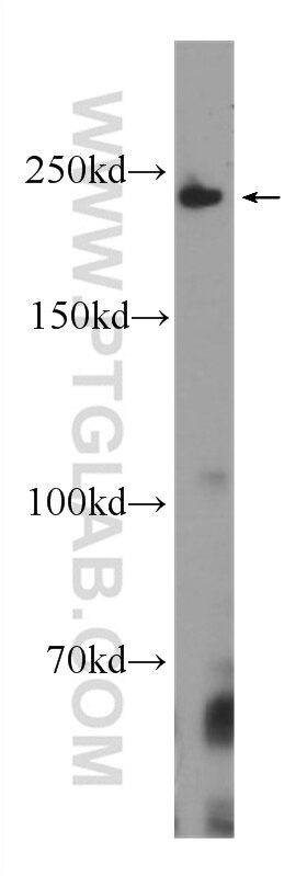 SMMHC Monoclonal antibody