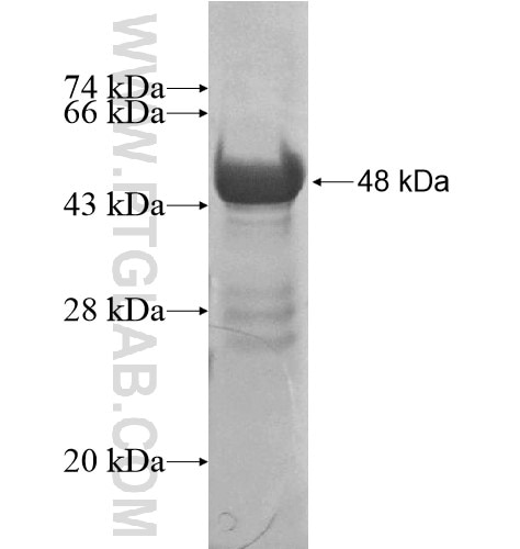 MYH11 fusion protein Ag13397 SDS-PAGE
