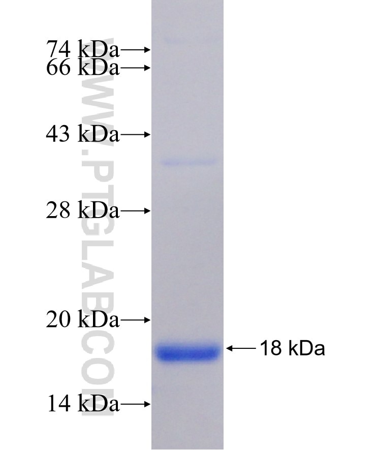 MYH11 fusion protein Ag17068 SDS-PAGE