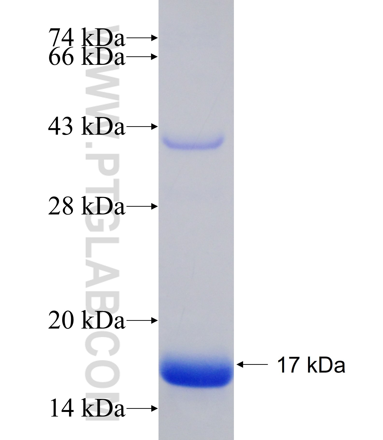 MYH11 fusion protein Ag17068 SDS-PAGE MYH11 fusion protein Ag17068 SDS-PAGE
