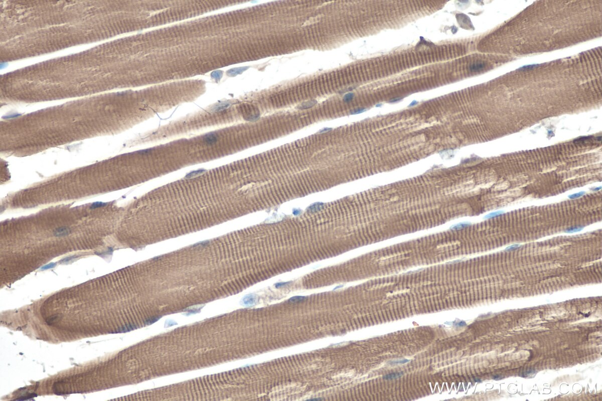 Immunohistochemistry (IHC) staining of mouse skeletal muscle tissue using MYH13 Polyclonal antibody (22286-1-AP)