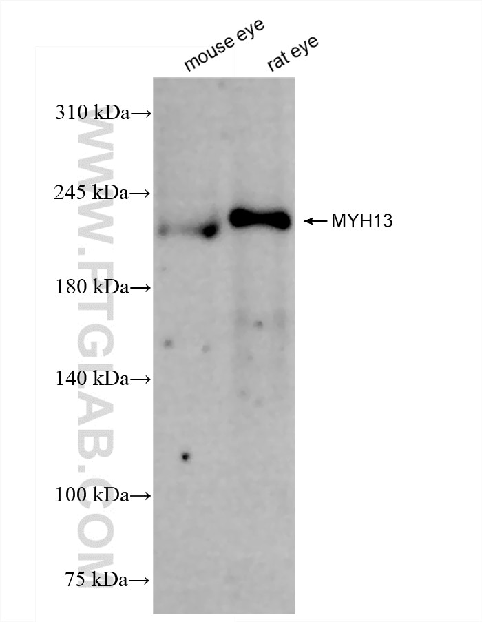 Western Blot (WB) analysis of various lysates using MYH13 Recombinant antibody (84379-2-RR)