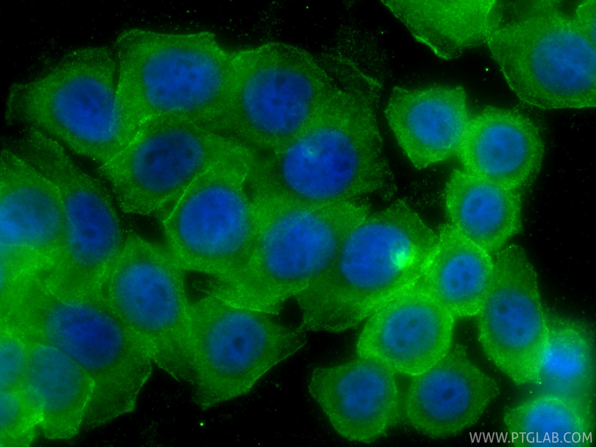 Immunofluorescence (IF) / fluorescent staining of HT-29 cells using MYH14 Polyclonal antibody (20716-1-AP)