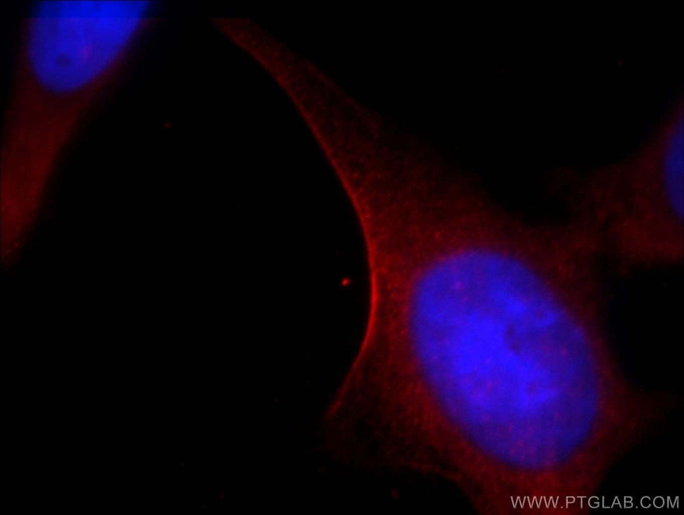 Immunofluorescence (IF) / fluorescent staining of HeLa cells using MYH14 Polyclonal antibody (20716-1-AP)