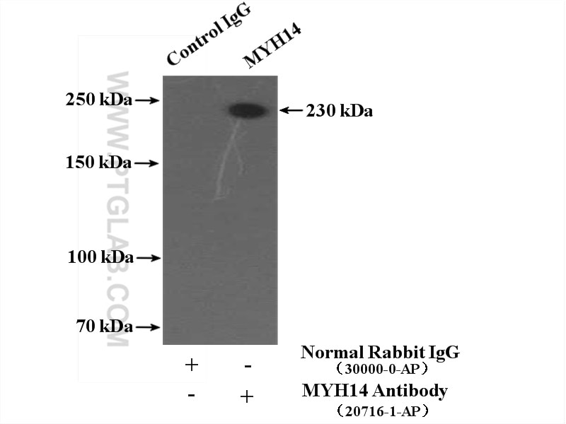Immunoprecipitation (IP) experiment of mouse kidney tissue using MYH14 Polyclonal antibody (20716-1-AP)