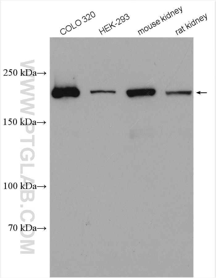 Western Blot (WB) analysis of various lysates using MYH14 Polyclonal antibody (20716-1-AP)