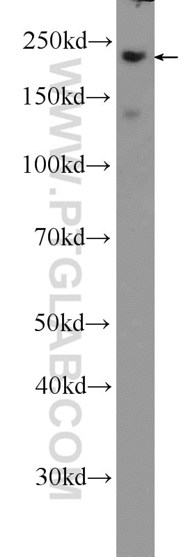 Western Blot (WB) analysis of mouse colon tissue using MYH14 Polyclonal antibody (20716-1-AP)