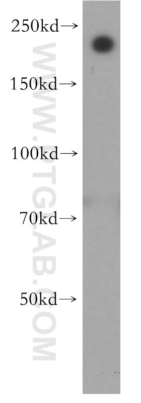 Western Blot (WB) analysis of human skeletal muscle tissue using MYH14 Polyclonal antibody (20716-1-AP)