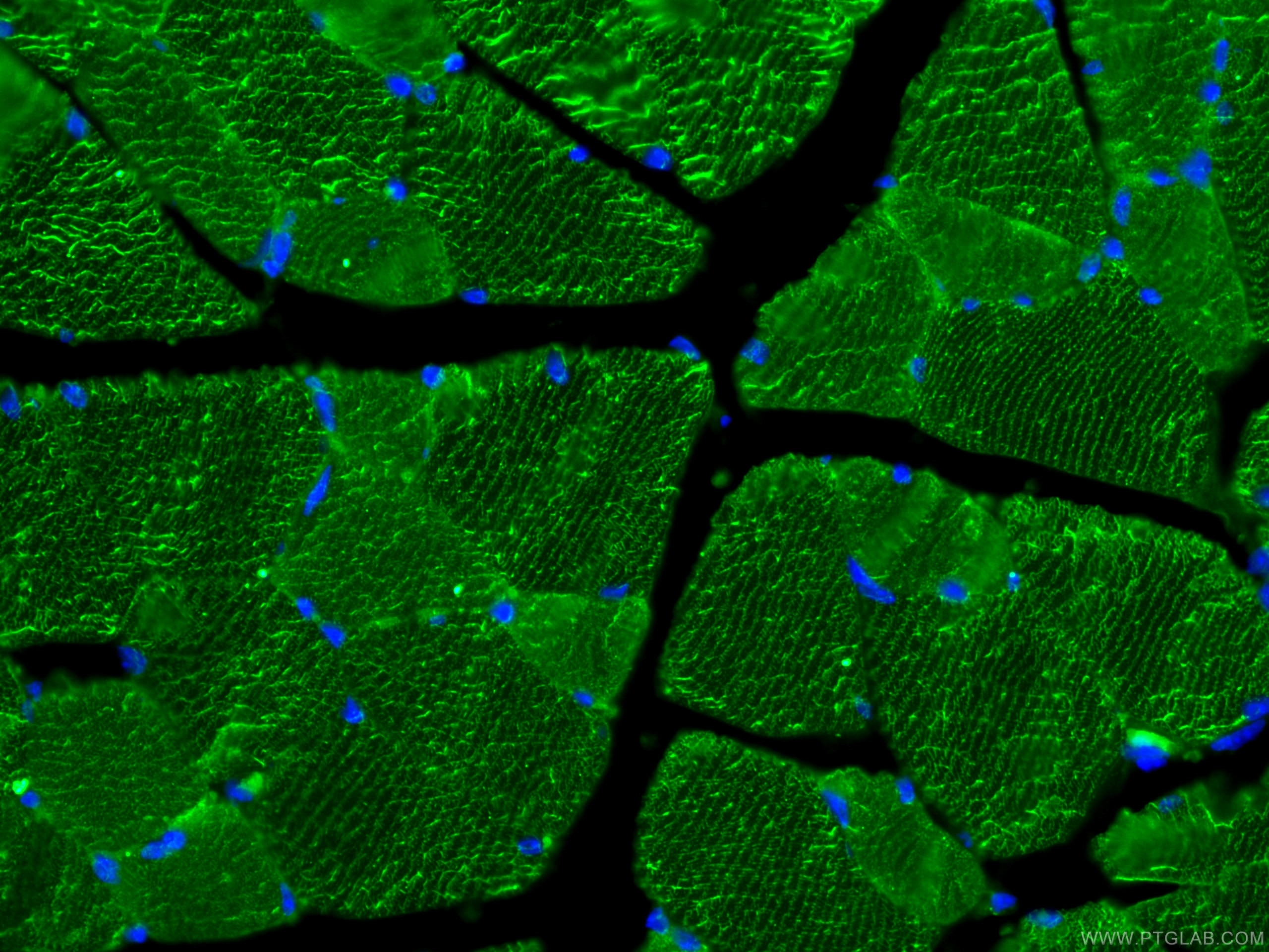 Immunofluorescence (IF) / fluorescent staining of mouse skeletal muscle tissue using MYH14 Monoclonal antibody (66825-1-Ig)
