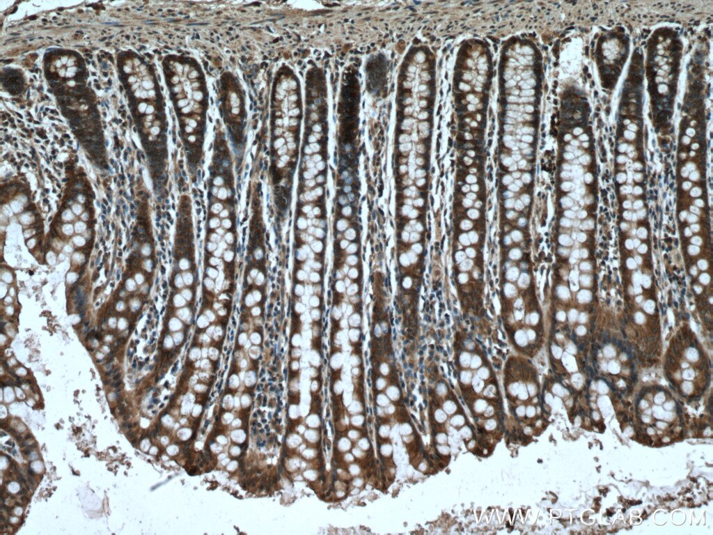 IHC staining of human colon using 66825-1-Ig