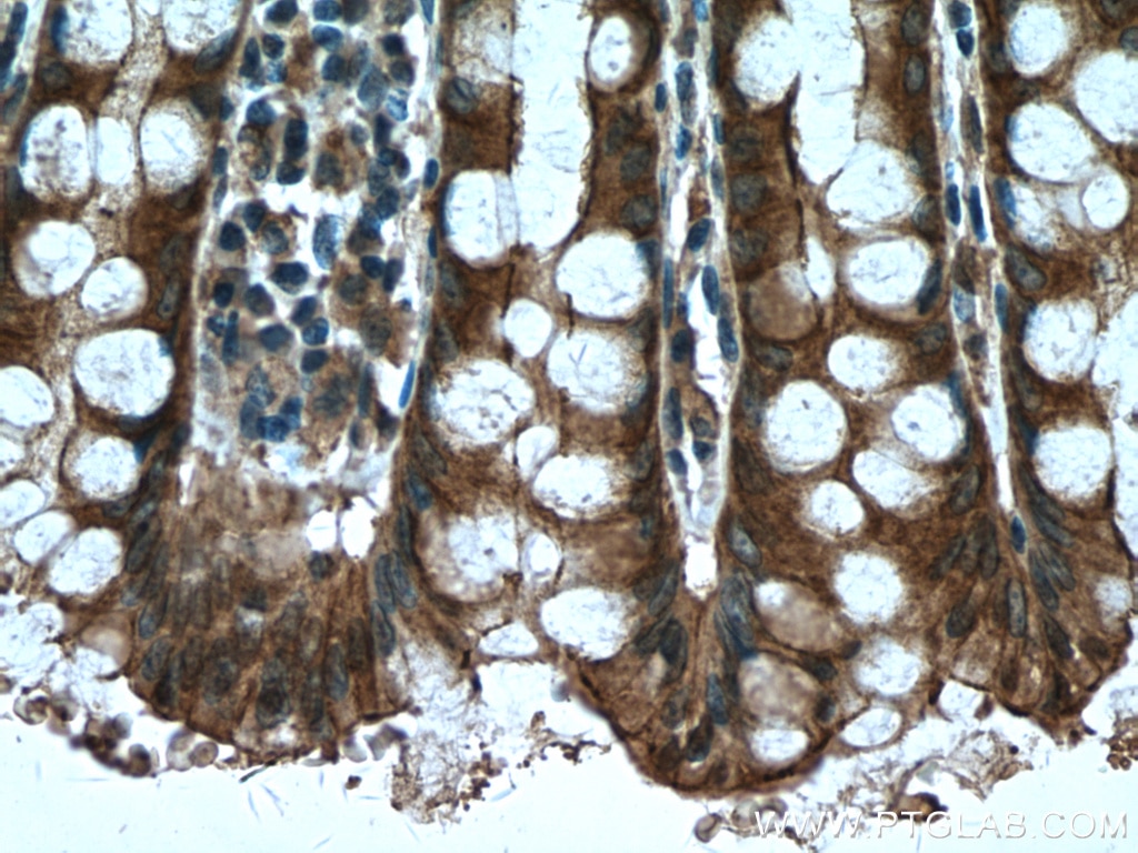 Immunohistochemistry (IHC) staining of human colon tissue using MYH14 Monoclonal antibody (66825-1-Ig)