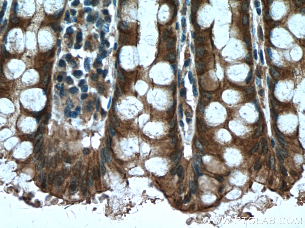 IHC staining of human colon using 66825-1-Ig