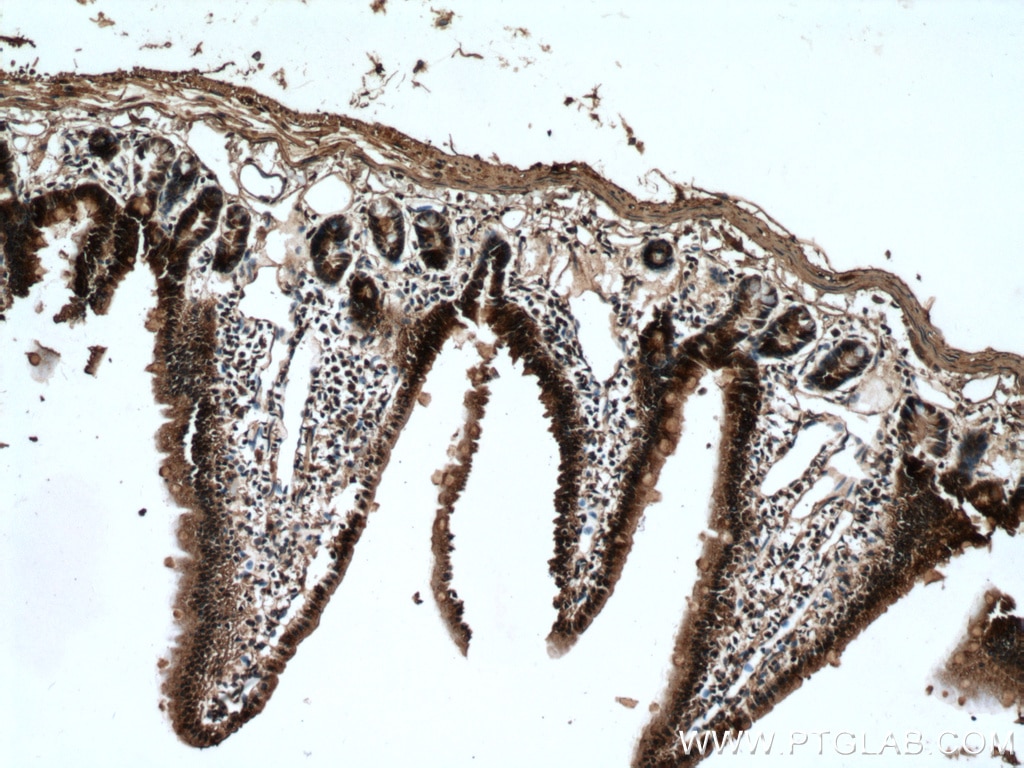 Immunohistochemistry (IHC) staining of mouse small intestine tissue using MYH14 Monoclonal antibody (66825-1-Ig)