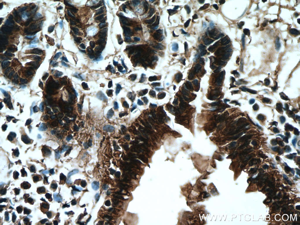 Immunohistochemistry (IHC) staining of mouse small intestine tissue using MYH14 Monoclonal antibody (66825-1-Ig)