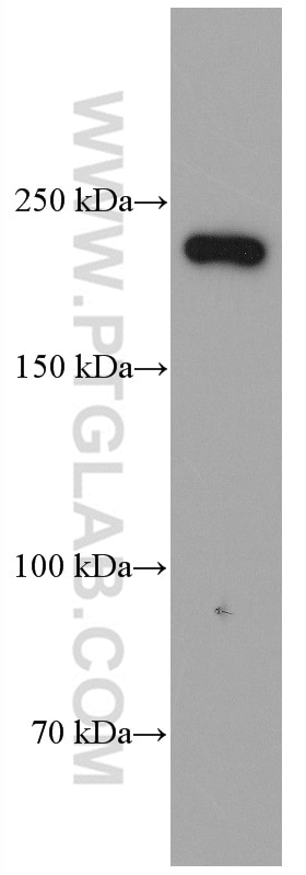 Western Blot (WB) analysis of COLO 320 cells using MYH14 Monoclonal antibody (66825-1-Ig)