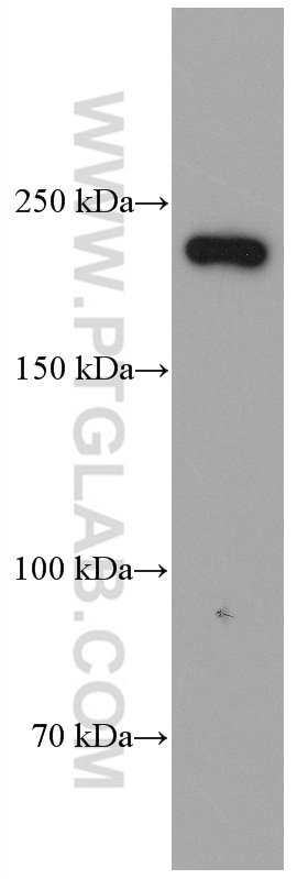 WB analysis of COLO 320 using 66825-1-Ig