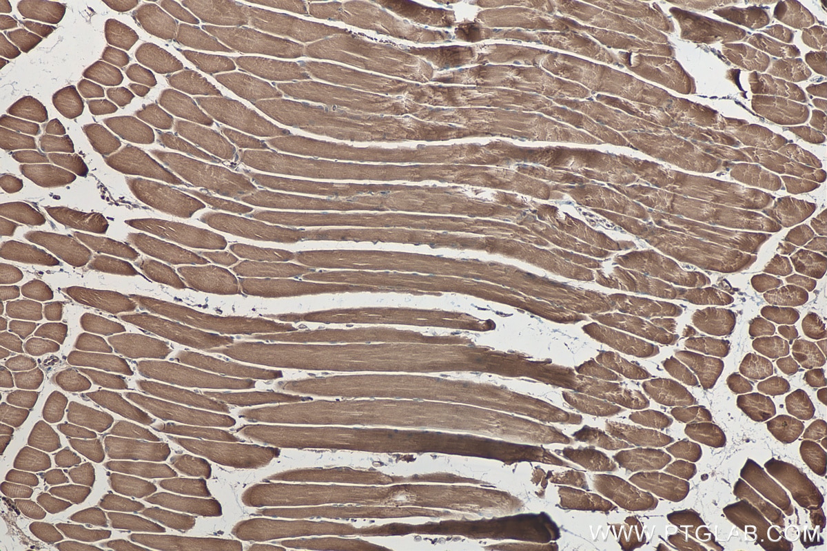 Immunohistochemistry (IHC) staining of mouse skeletal muscle tissue using MYH15 Polyclonal antibody (22290-1-AP)