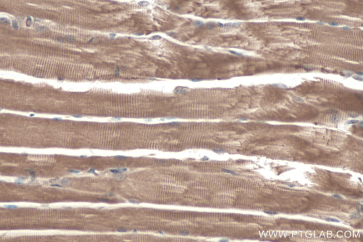 Immunohistochemistry (IHC) staining of mouse skeletal muscle tissue using MYH15 Polyclonal antibody (22290-1-AP)