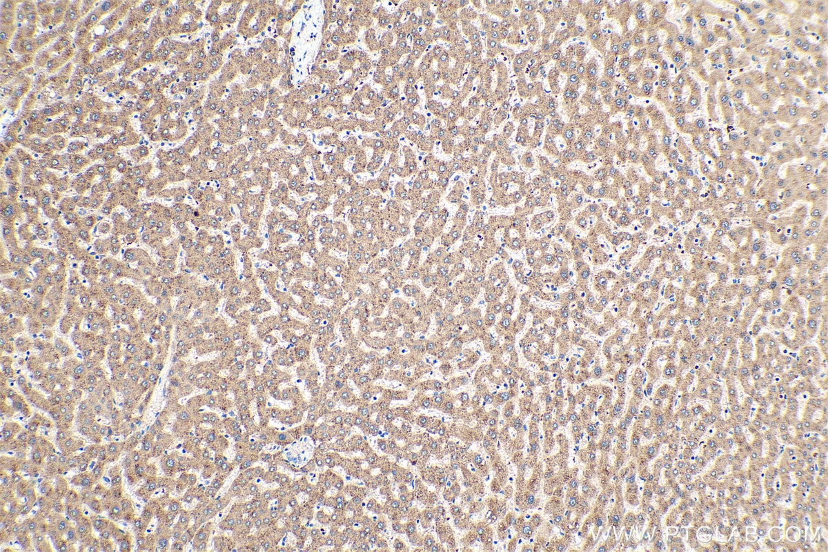 Immunohistochemistry (IHC) staining of human liver tissue using MYH15 Polyclonal antibody (22290-1-AP)