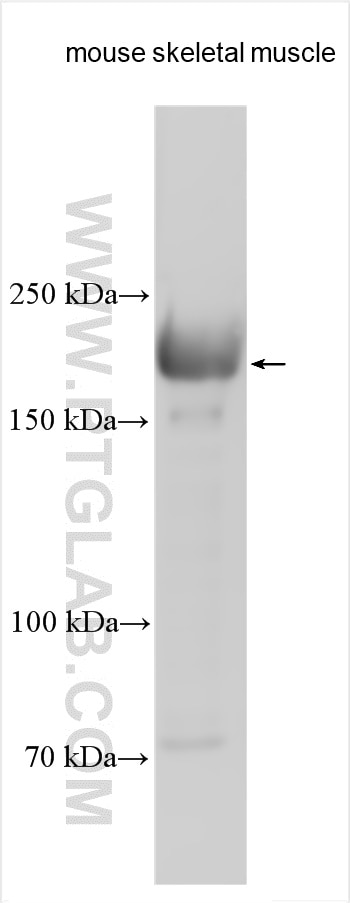 Western Blot (WB) analysis of various lysates using MYH15 Polyclonal antibody (22290-1-AP)