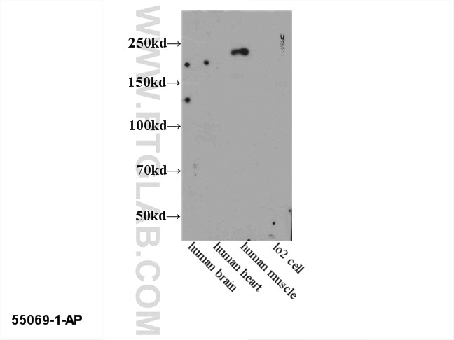 Western Blot (WB) analysis of multi-cells/tissue using MYH2-specific Polyclonal antibody (55069-1-AP)